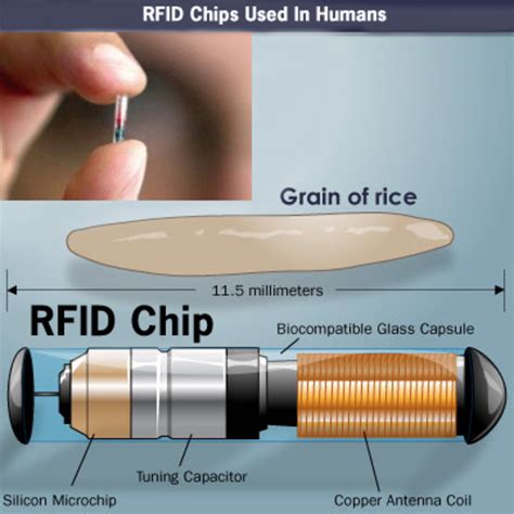 rfid chip surgery|rfid chip implantation.